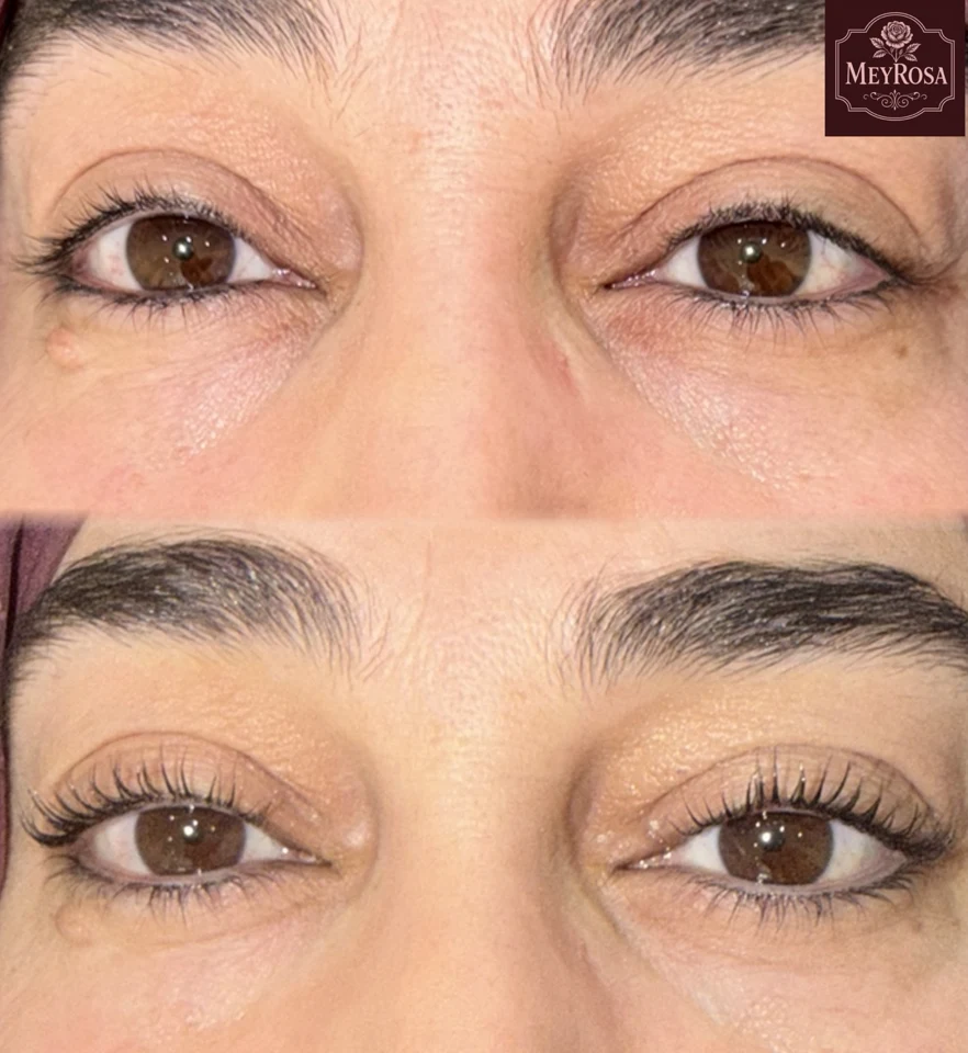 Meyrosa — lash lifting 2